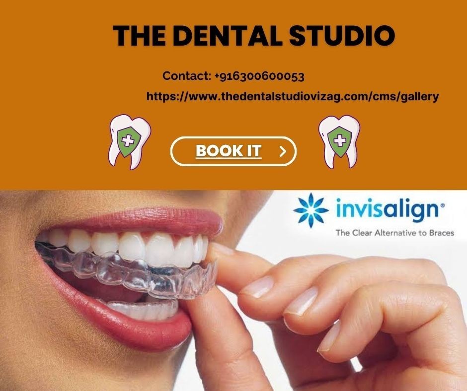 Best Dental clinic in Vizag  Invisalign Treatment in vizag  Best Den